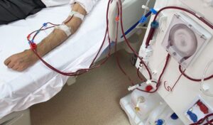 Dialysis-640×375